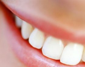 Il dentista costa caro: al Nord la crisi riduce le visite