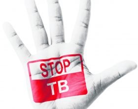 In calo in Piemonte i casi di Tubercolosi grazie al sistema di diagnosi e prevenzione