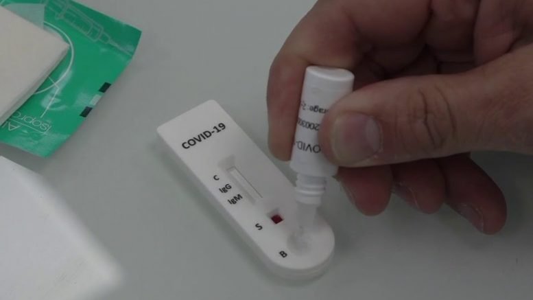Test sierologici volontari al personale scolastico: ecco dove farli in provincia di Alessandria