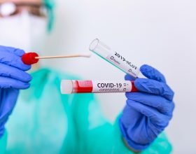 Icardi: “Il bollettino nazionale terrà conto anche dei test antigenici”