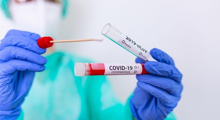 Icardi: “Il bollettino nazionale terrà conto anche dei test antigenici”