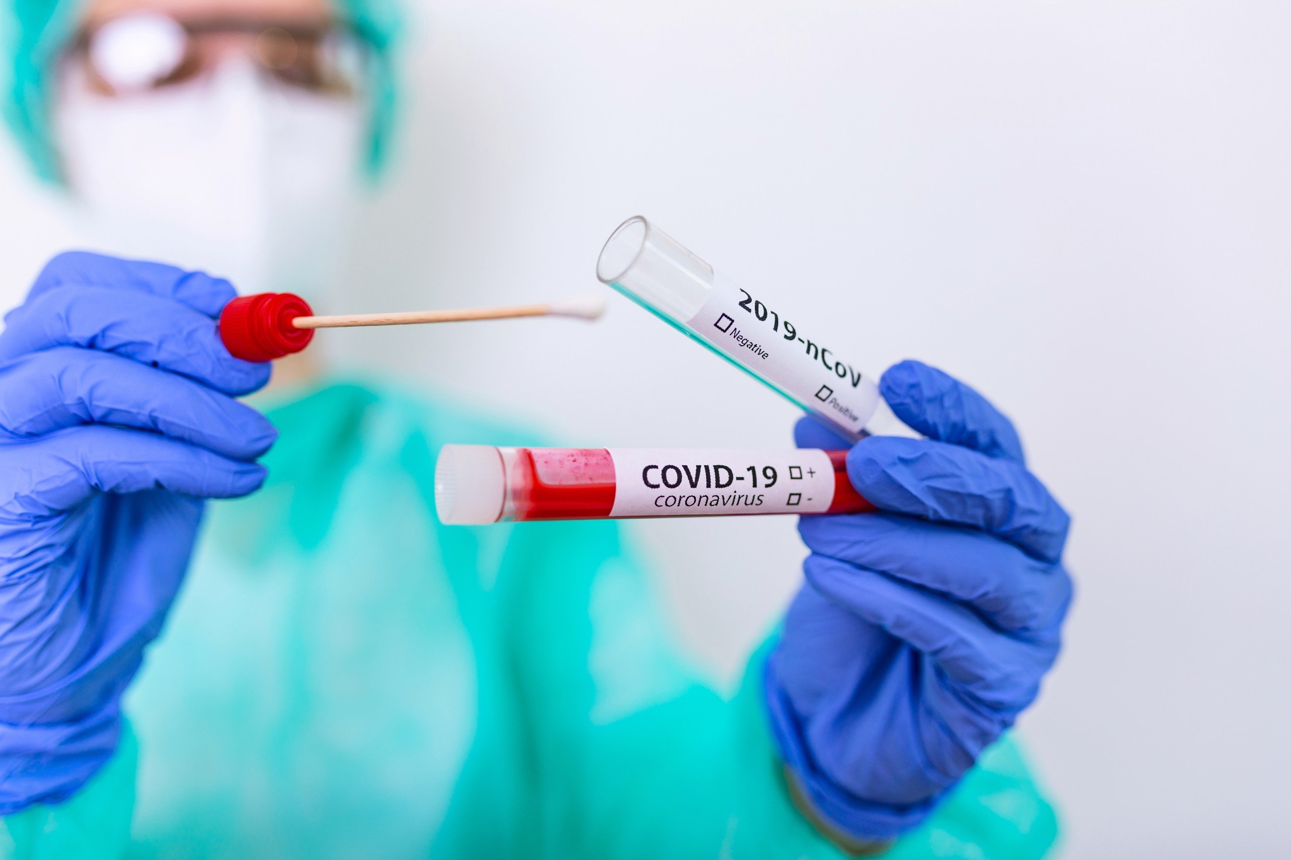 Bollettino coronavirus: sono 2287 i contagi in Piemonte. Nell’Alessandrino 165 positivi e un decesso