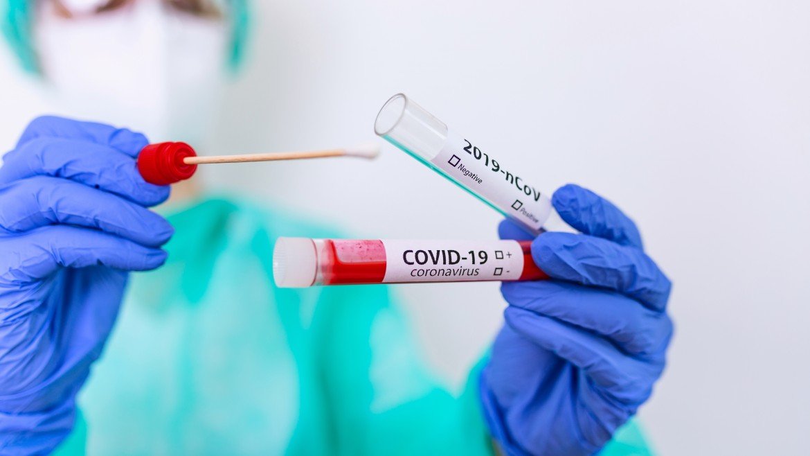 Bollettino coronavirus: in Piemonte 3.281 contagi e 63 decessi. In provincia i nuovi positivi sono 219