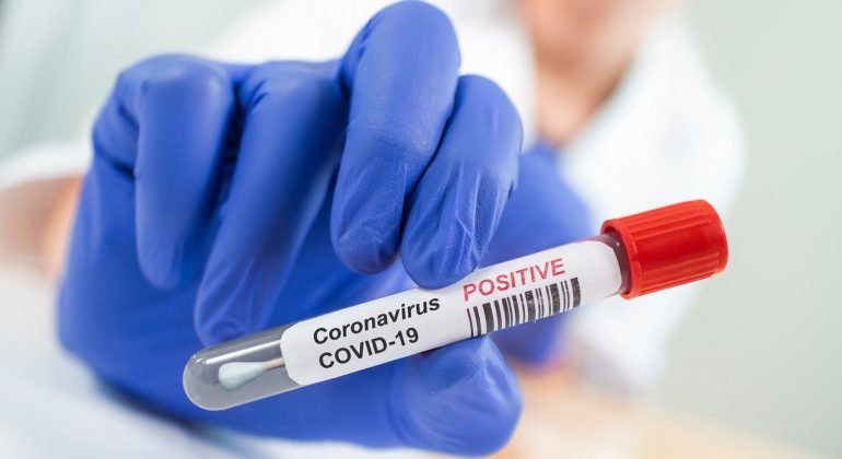 Bollettino coronavirus: 974 nuovi contagi e 84 decessi in Piemonte
