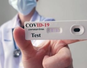 Bollettino coronavirus: 475 nuovi positivi e 17 decessi in Piemonte