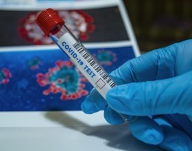 Bollettino coronavirus: in Piemonte altri 7652 nuovi contagi e 17 morti