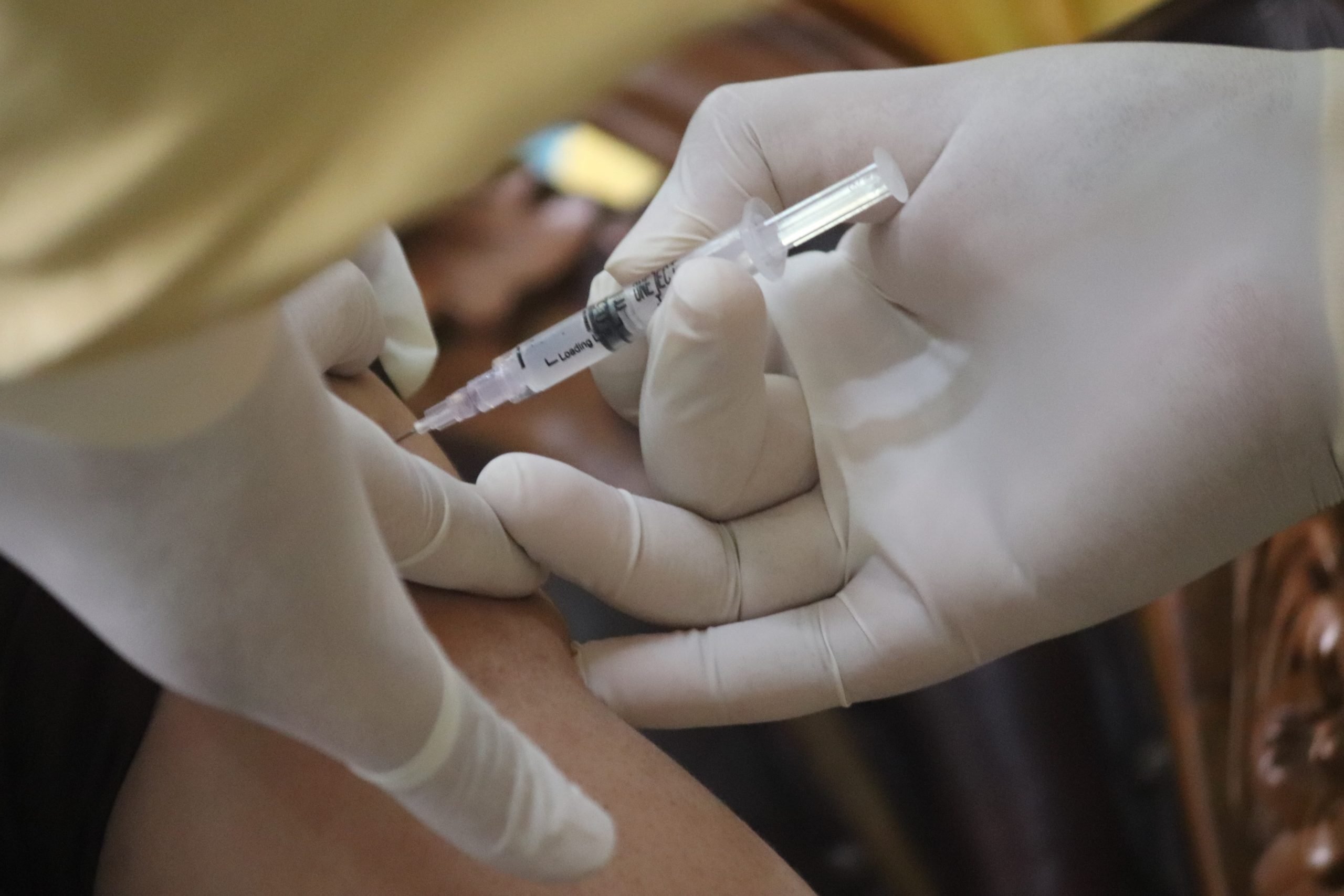 Un braccio in silicone per ingannare l’infermiera e farsi vaccinare: folle gesto a Biella
