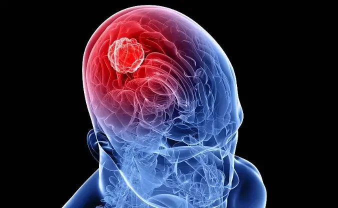 Tumore testa collo: dal 19 al 23 settembre visite per la diagnosi precoce
