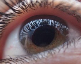 Settimana glaucoma: martedì visite gratuite a Valenza