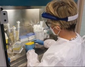 Il laboratorio dell’Ospedale di Alessandria dove si congela il microbiota intestinale, arma terapeutica salva-vita che apre la strada alla ricerca