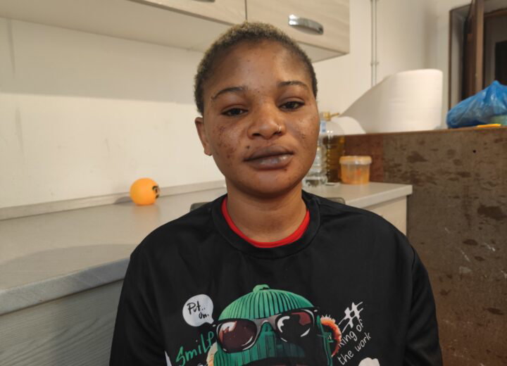 Parla la donna presa a cinghiate sul bus da due ragazzi: “Ho chiesto scusa dopo averli urtati, non è bastato”