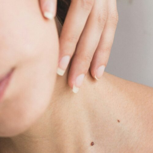 24 maggio, Giornata Europea del Melanoma: cresce l’attenzione sulla prevenzione dei tumori della pelle