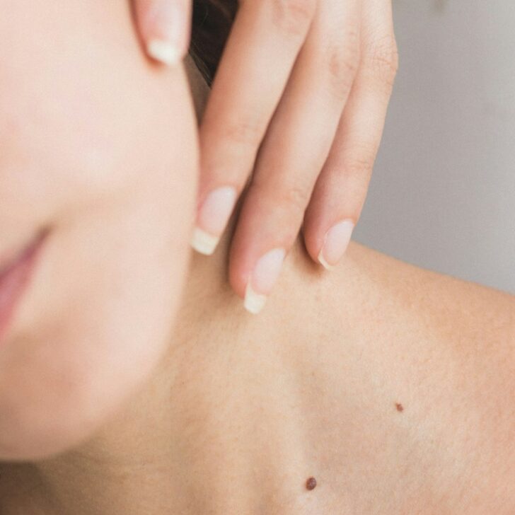 24 maggio, Giornata Europea del Melanoma: cresce l’attenzione sulla prevenzione dei tumori della pelle