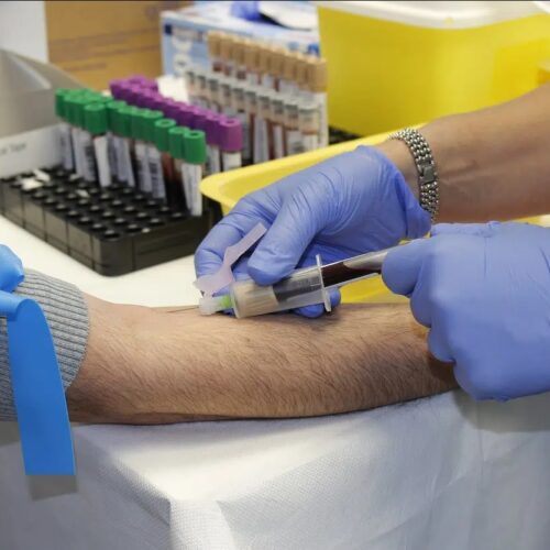 PFAS a Spinetta Marengo, i comitati attaccano la Regione: “Senza risposte e con i veleni nel sangue”