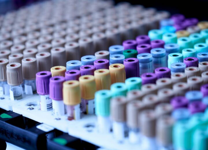 Pfas: studio università di Pavia e Pisa svela la doppia interferenza sulla funzione tiroidea e il neurosviluppo