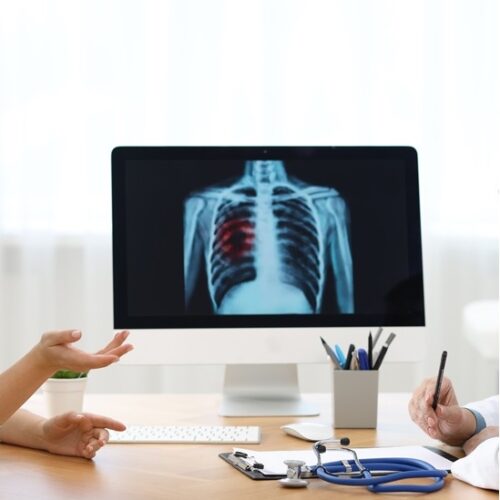 Al via da Pavia lo screening regionale gratuito per il tumore del polmone