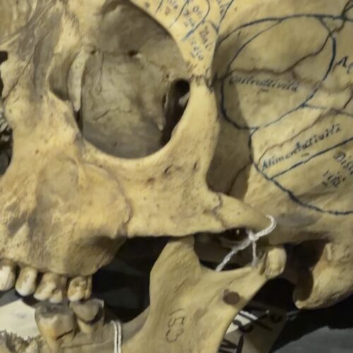 Alessandria, 250 crani e gli strumenti dell’ex manicomio: il Museo Lombroso apre per un giorno