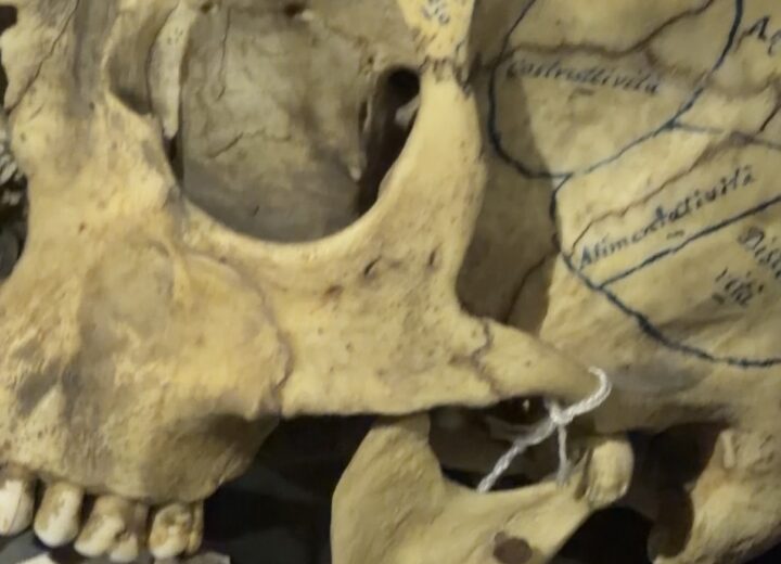 Alessandria, 250 crani e gli strumenti dell’ex manicomio: il Museo Lombroso apre per un giorno