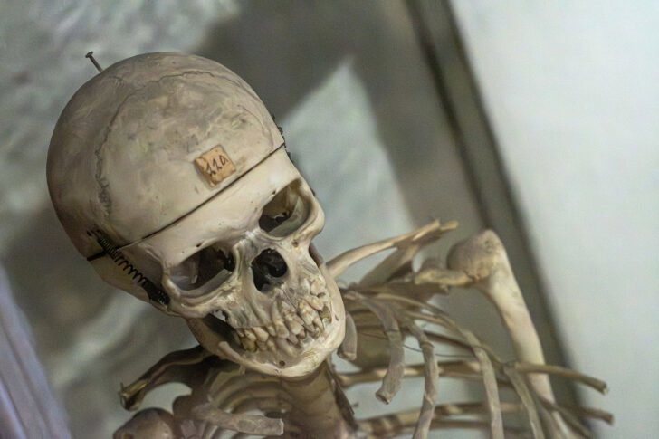 Museo Lombroso, apertura straordinaria sold out: grande interesse per la storia dell’ex manicomio di Alessandria