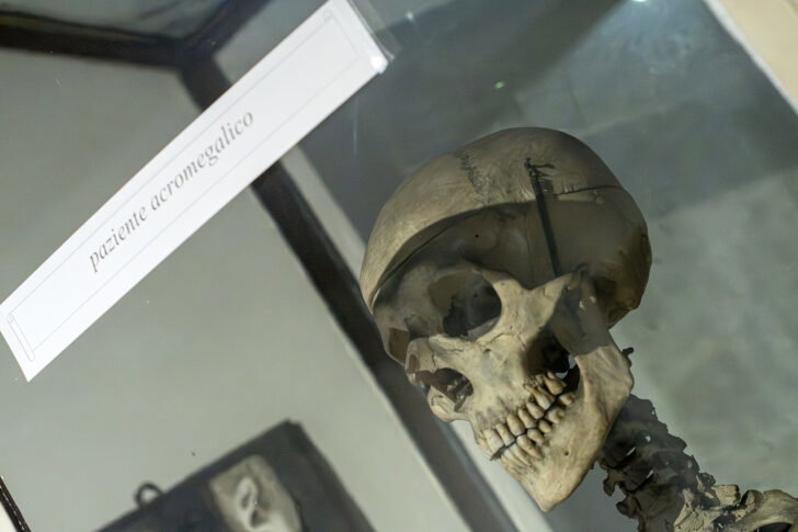 Museo Lombroso, apertura straordinaria sold out: grande interesse per la storia dell’ex manicomio di Alessandria
